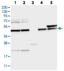 BROX, Rabbit, Polyclonal Antibody, Abnova 100 &mu;L | Buy Online | Abnova Corporation | Fisher Scientific