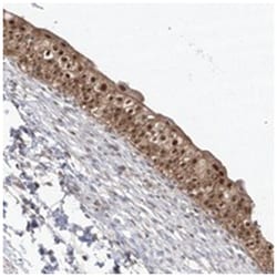 BROX, Rabbit, Polyclonal Antibody, Abnova 100 &mu;L | Buy Online | Abnova Corporation | Fisher Scientific