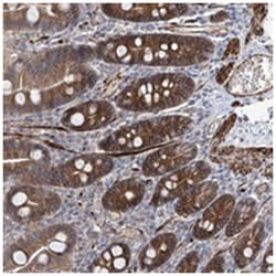 FAM83B Rabbit anti-Human, Polyclonal Antibody, Abnova 100 &mu;L | Buy Online | Abnova Corporation | Fisher Scientific