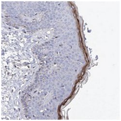 HRNR, Rabbit, Polyclonal Antibody, Abnova 100&mu;L; Unlabeled:Antibodies,