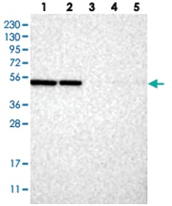 C2orf30 Rabbit anti-Human, Mouse, Polyclonal Antibody, Abnova 100 &mu;L | Buy Online | Abnova Corporation | Fisher Scientific