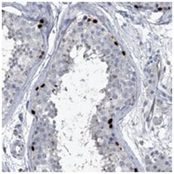 HEPHL1, Rabbit, Polyclonal Antibody, Abnova 100 &mu;L | Buy Online | Abnova Corporation | Fisher Scientific