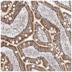 CXorf58, Rabbit, Polyclonal Antibody, Abnova 100 &mu;L | Buy Online | Abnova Corporation | Fisher Scientific