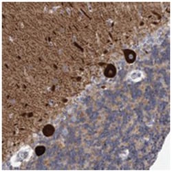 KCTD8, Rabbit, Polyclonal Antibody, Abnova 100 &mu;L | Buy Online | Abnova Corporation | Fisher Scientific