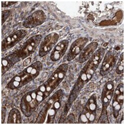 ASCC3 Rabbit anti-Human, Polyclonal Antibody, Abnova 100&mu;L; Unlabeled:Antibodies,