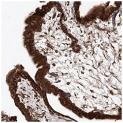 ASCC3 Rabbit anti-Human, Polyclonal Antibody, Abnova 100&mu;L; Unlabeled:Antibodies,