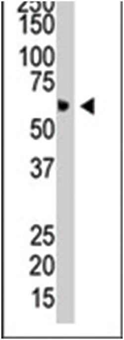 PIAS4 Rabbit anti-Human, Polyclonal Antibody, Abnova 400 &mu;L | Buy Online | Abnova Corporation | Fisher Scientific