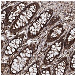 ASCC3 Rabbit anti-Human, Polyclonal Antibody, Abnova 100 &mu;L | Buy Online | Abnova Corporation | Fisher Scientific
