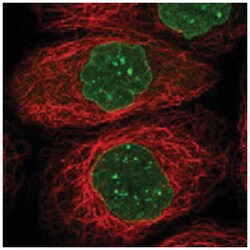 AHCTF1, Rabbit, Polyclonal Antibody, Abnova 100 &mu;L | Buy Online | Abnova Corporation | Fisher Scientific