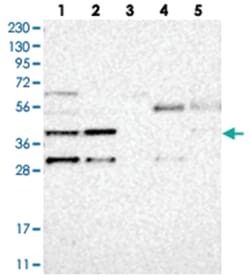MB21D1, Rabbit, Polyclonal Antibody, Abnova 100&mu;L; Unlabeled:Antibodies,