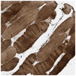 MB21D1, Rabbit, Polyclonal Antibody, Abnova 100&mu;L; Unlabeled:Antibodies,