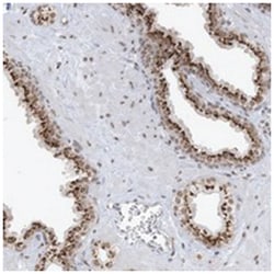 GPR107, Rabbit, Polyclonal Antibody, Abnova 100&mu;L; Unlabeled:Antibodies,