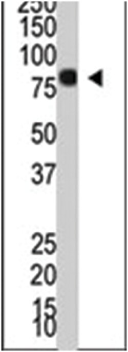 PIAS4 Rabbit anti-Human, Polyclonal Antibody, Abnova 400 &mu;L | Buy Online | Abnova | Fisher Scientific