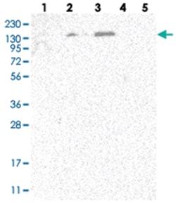 SPOCD1, Rabbit, Polyclonal Antibody, Abnova 100 &mu;L | Buy Online | Abnova | Fisher Scientific