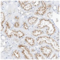 SPOCD1, Rabbit, Polyclonal Antibody, Abnova 100 &mu;L | Buy Online | Abnova | Fisher Scientific