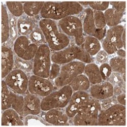 TCTE1, Rabbit, Polyclonal Antibody, Abnova 100 &mu;L | Buy Online | Abnova Corporation | Fisher Scientific