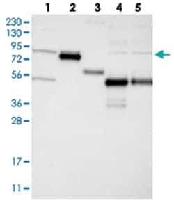GLT25D2 Rabbit anti-Human, Mouse, Rat, Polyclonal Antibody, Abnova 100&mu;L;