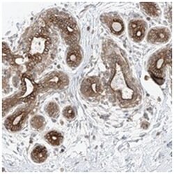 GLT25D2 Rabbit anti-Human, Mouse, Rat, Polyclonal Antibody, Abnova 100&mu;L;