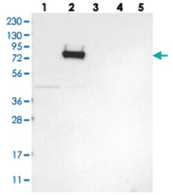 GLT25D2 Rabbit anti-Human, Polyclonal Antibody, Abnova 100&mu;L; Unlabeled:Antibodies,
