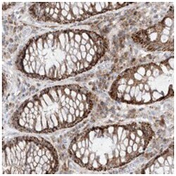 GLT25D2 Rabbit anti-Human, Polyclonal Antibody, Abnova 100&mu;L; Unlabeled:Antibodies,