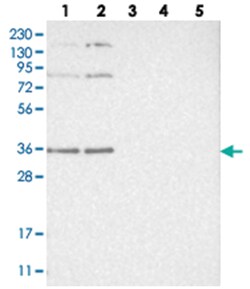 WRNIP1 Rabbit anti-Human, Polyclonal Antibody, Abnova 100&mu;L; Unlabeled:Antibodies,