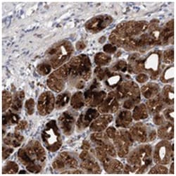 KIAA1919, Rabbit, Polyclonal Antibody, Abnova 100 &mu;L | Buy Online | Abnova | Fisher Scientific