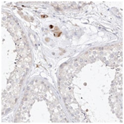 ZZEF1 Rabbit anti-Human, Polyclonal Antibody, Abnova 100 &mu;L | Buy Online | Abnova Corporation | Fisher Scientific