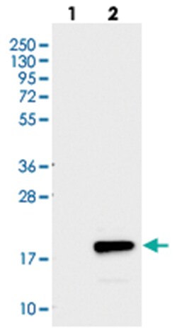 C6orf57, Rabbit, Polyclonal Antibody, Abnova 100&mu;L; Unlabeled:Antibodies,