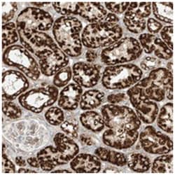 PLCL1, Rabbit, Polyclonal Antibody, Abnova 100&mu;L; Unlabeled:Antibodies,