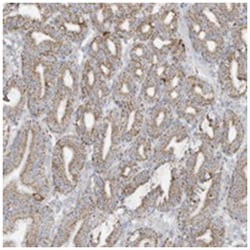 NLN, Rabbit, Polyclonal Antibody, Abnova 100&mu;L; Unlabeled:Antibodies,