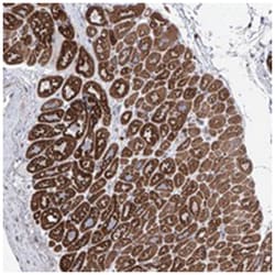 LCLAT1, Rabbit, Polyclonal Antibody, Abnova 100 &mu;L | Buy Online | Abnova Corporation | Fisher Scientific