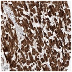 CACNA2D4, Rabbit, Polyclonal Antibody, Abnova 100 &mu;L | Buy Online | Abnova Corporation | Fisher Scientific