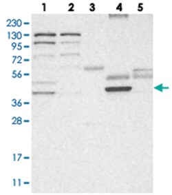 HPDL, Rabbit, Polyclonal Antibody, Abnova 100 &mu;L | Buy Online | Abnova Corporation | Fisher Scientific