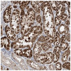 HPDL, Rabbit, Polyclonal Antibody, Abnova 100 &mu;L | Buy Online | Abnova Corporation | Fisher Scientific
