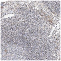 UST, Rabbit, Polyclonal Antibody, Abnova 100&mu;L; Unlabeled:Antibodies,