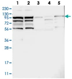 KIAA1522, Rabbit, Polyclonal Antibody, Abnova 100 &mu;L | Buy Online | Abnova Corporation | Fisher Scientific