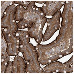 KIAA1522, Rabbit, Polyclonal Antibody, Abnova 100 &mu;L | Buy Online | Abnova Corporation | Fisher Scientific