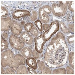 ZC3H12A Rabbit anti-Human, Polyclonal Antibody, Abnova 100 &mu;L | Buy Online | Abnova Corporation | Fisher Scientific