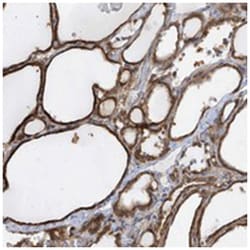 KLHDC9, Rabbit, Polyclonal Antibody, Abnova 100&mu;L; Unlabeled:Antibodies,