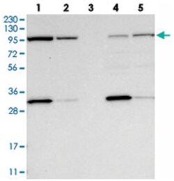 EXOC2 Rabbit anti-Human, Mouse, Rat, Polyclonal Antibody, Abnova 100&mu;L;