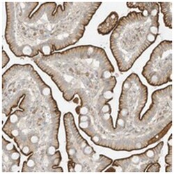 FAM161A, Rabbit, Polyclonal Antibody, Abnova 100 &mu;L | Buy Online | Abnova Corporation | Fisher Scientific