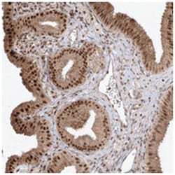SNRNP27, Rabbit, Polyclonal Antibody, Abnova 100 &mu;L | Buy Online | Abnova Corporation | Fisher Scientific