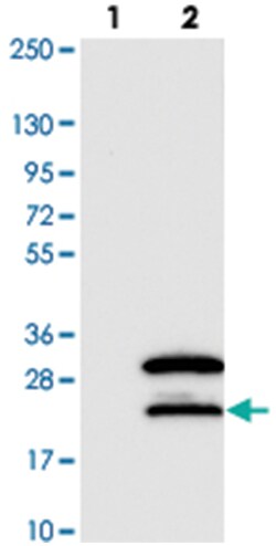 SNRNP27, Rabbit, Polyclonal Antibody, Abnova 100 &mu;L | Buy Online | Abnova Corporation | Fisher Scientific