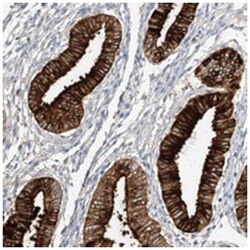 SCGB2A1 Rabbit anti-Human, Polyclonal Antibody, Abnova 100 &mu;L | Buy Online | Abnova Corporation | Fisher Scientific