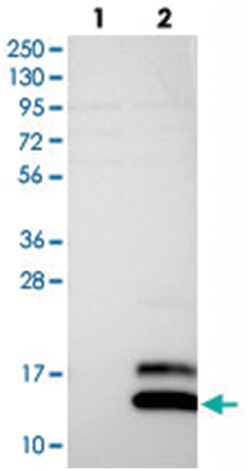 SCGB2A1 Rabbit anti-Human, Polyclonal Antibody, Abnova 100 &mu;L | Buy Online | Abnova Corporation | Fisher Scientific