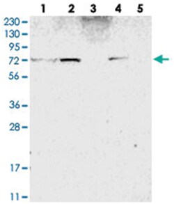 ZNF846, Rabbit, Polyclonal Antibody, Abnova 100&mu;L; Unlabeled:Antibodies,