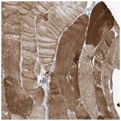 ZNF846, Rabbit, Polyclonal Antibody, Abnova 100&mu;L; Unlabeled:Antibodies,