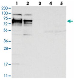 HS6ST2, Rabbit, Polyclonal Antibody, Abnova 100&mu;L; Unlabeled:Antibodies,
