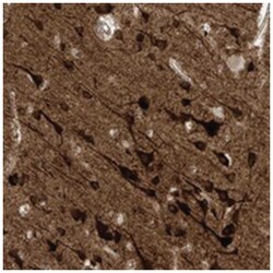 HS6ST2, Rabbit, Polyclonal Antibody, Abnova 100&mu;L; Unlabeled:Antibodies,