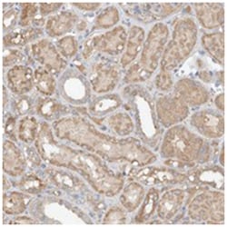 GNB1L, Rabbit, Polyclonal Antibody, Abnova 100 &mu;L | Buy Online | Abnova Corporation | Fisher Scientific